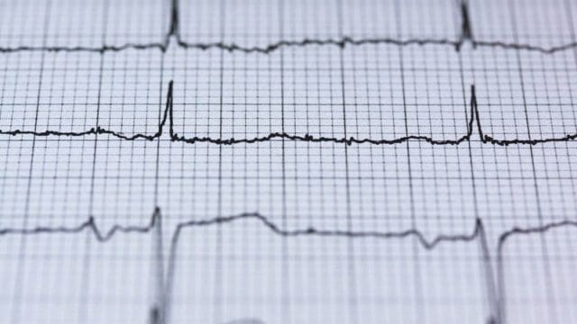 Cómo ocultar datos en los historiales médicos